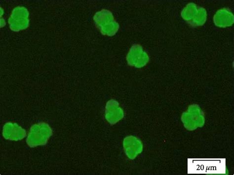 c anca serum pattern